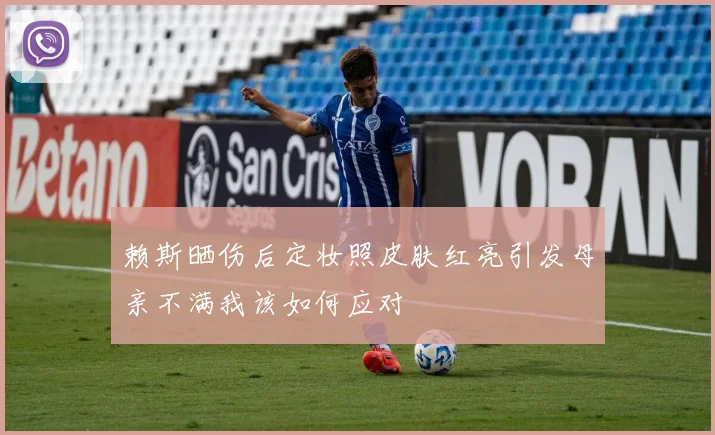 赖斯晒伤后定妆照皮肤红亮引发母亲不满我该如何应对